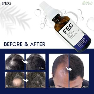 FEGPLUS Rosemary Beard & Hair Growth Serum (50ml), Rosemary Extract Serum Hair Spray, Rosemary Oil for Hair Growth Booster, Minoxidil Hair Fall Control, Stop Hair Loss Treatment & Thicker Hair